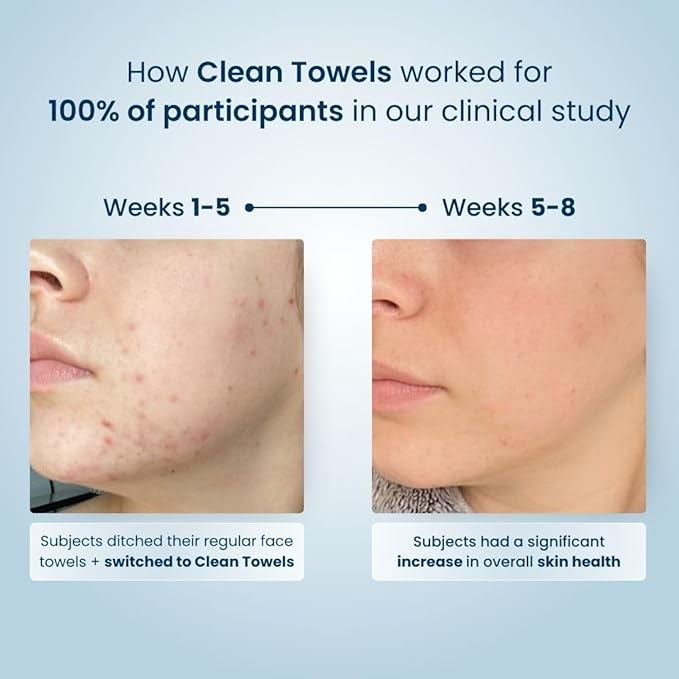 Clean Skin Club Clean Towels XL™, USDA Certified 100‪%‬ Biobased Dermatologist Approved Face Towel, Disposable Makeup Remover Dry Wipes, Facial Wash (4 pack)